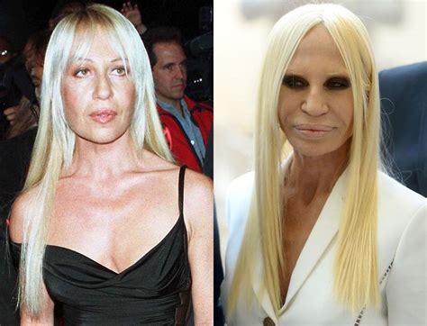 donatella versace jeune|Donatella Versace before and after.